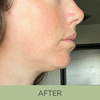 4 Step Clear Skin Routine